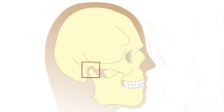 Kiefergelenksbehandlung